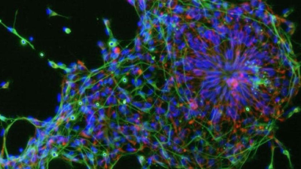 Un cultivo celular observado al microscopio.