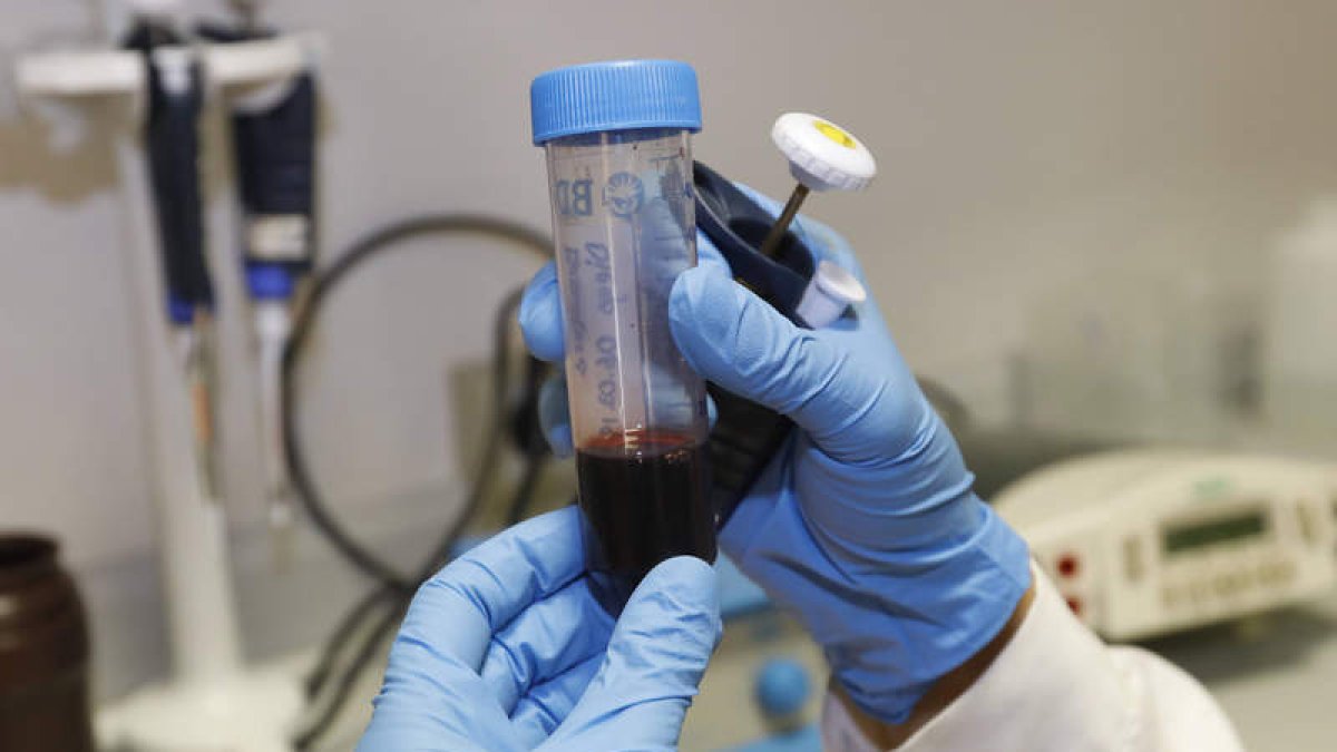 Estudio de un hígado en un laboratorio. MARCIANO PÉREZ
