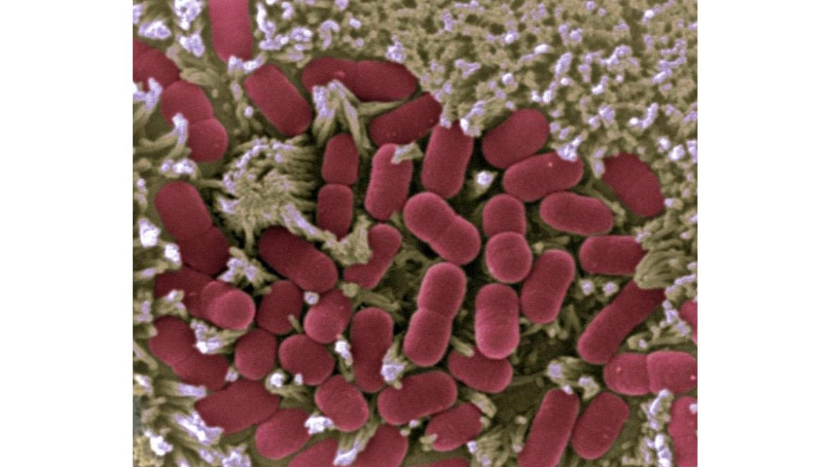 Imagen microscópica de la mucosa intestinal afectada por E.coli. CNB-CSIC