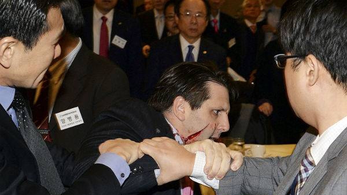 El agresor ha sido detenido tras cortarle con un cuchillo de cocina la cara y una mano.