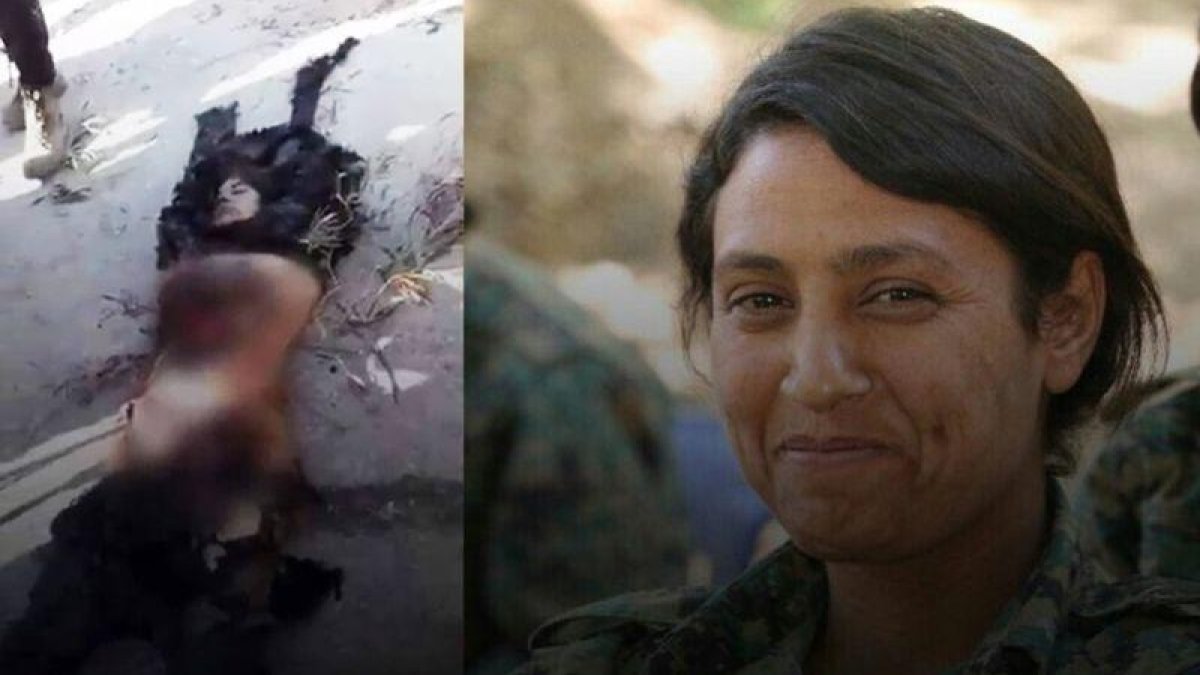 La combatienta Amina Omar conocida como Barin Kobane, mutilada por las fuerzas turco-sirias.