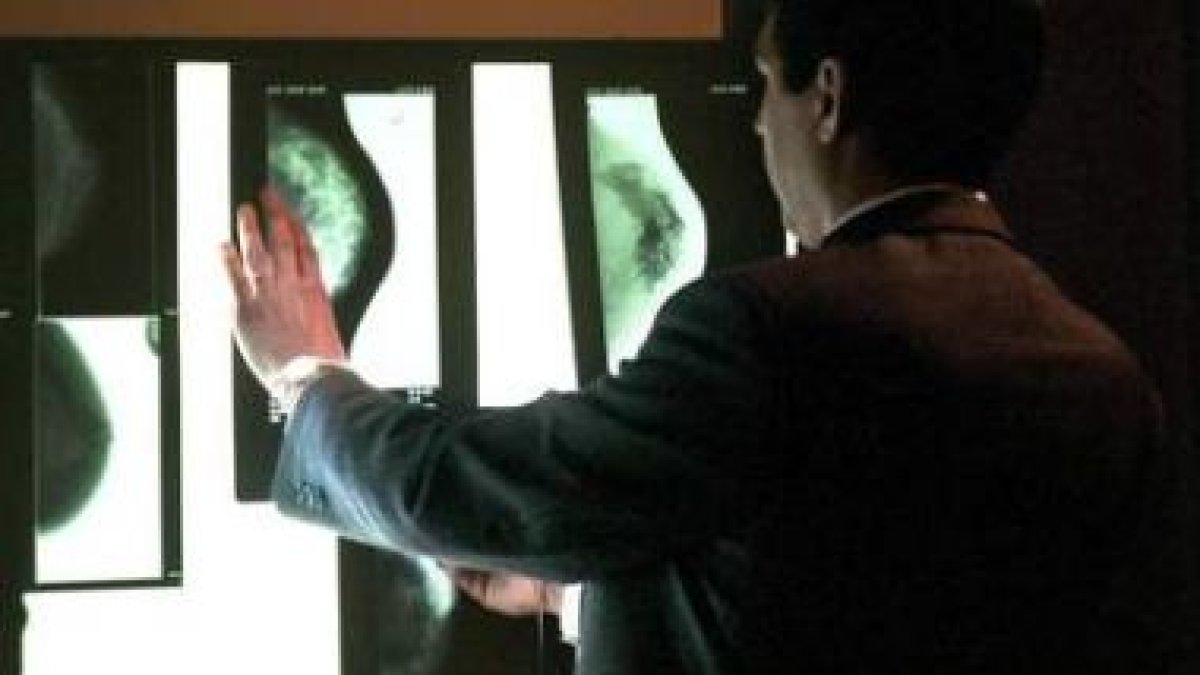 Un experto examina varias mamografías, en una imagen de archivo.