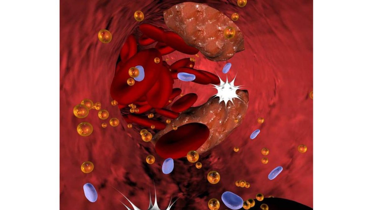 El hallazgo permite tratar la arteriosclerosis. Christina Lohmeyer