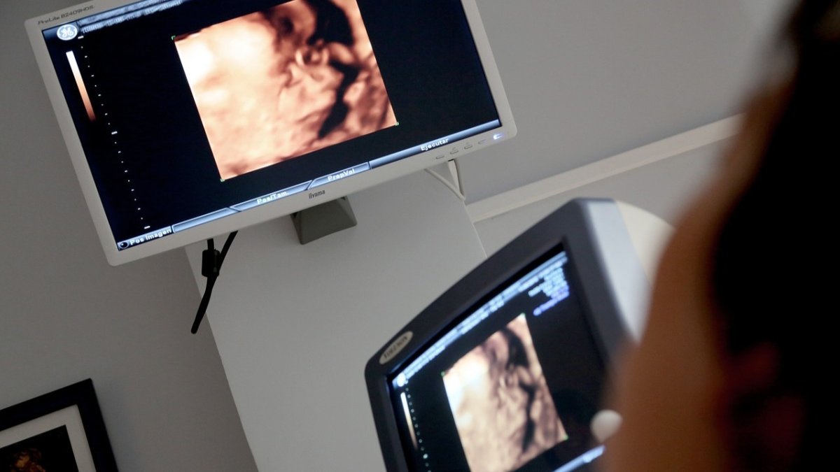 Un estudio investiga las afecciones cardíacas producidas a consecuencia de la exposición prenatal al alcohol. DL