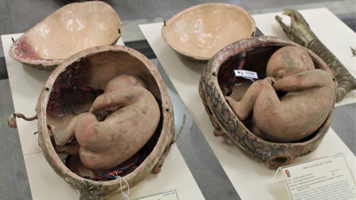 Dos reproducciones de fetos humanos formarán parte del futuro Museo Universitario.