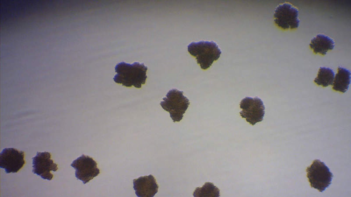Cinco microfotografías de micobacterias. Tres de ellas son colonias crecidas en líquido de tres especies distintas y las otras dos son cultivos de macrófagos humanos infectados in vitro.