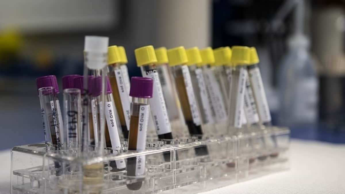 Pruebas ELISA ante el coronavirus: ¿Qué son y para qué sirven?