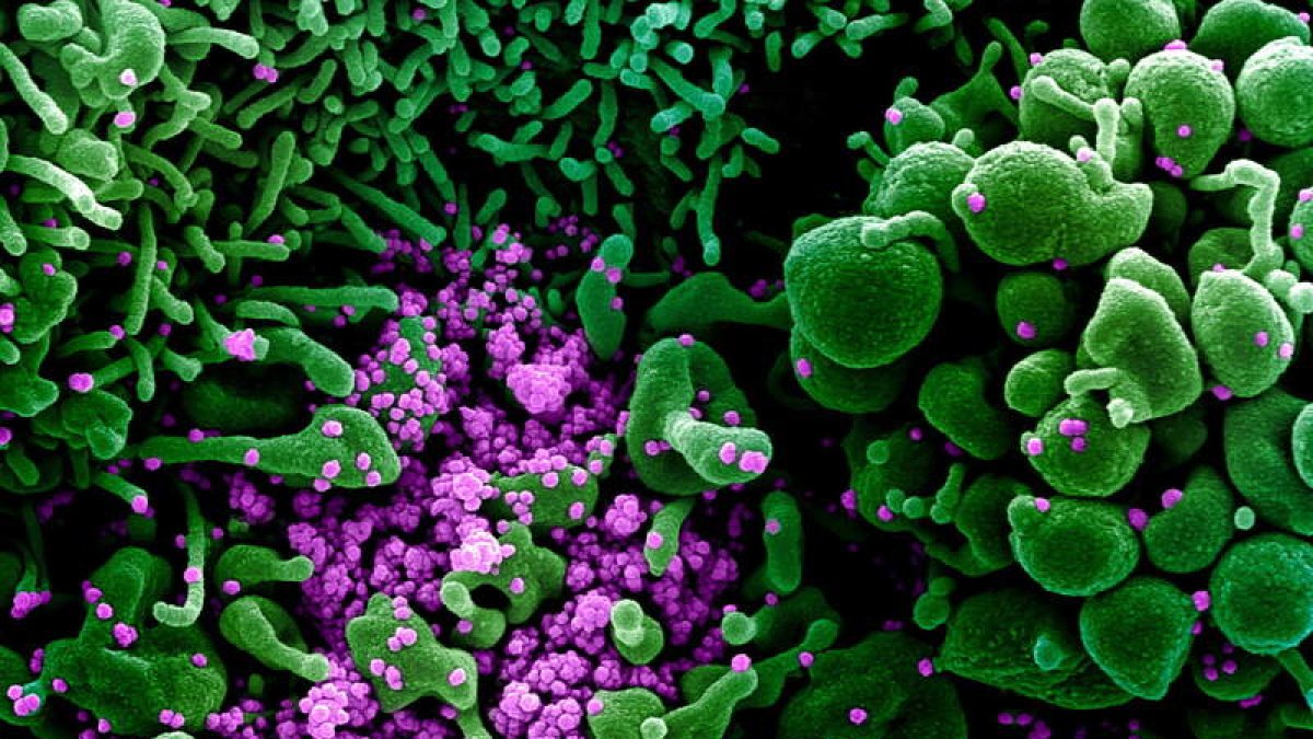 El efecto de las nanopartículas es letal con el coronavirus. efe