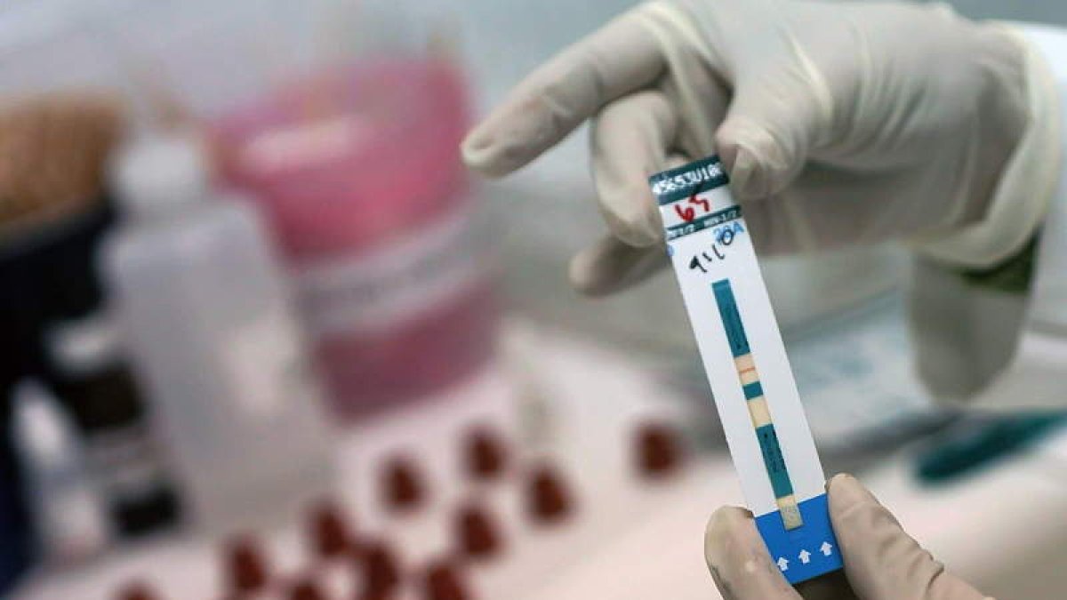 Los investigadores buscan nuevos fármacos para tratar el virus que causa 770.000 muertes al año. ULISES RODRÍGUEZ