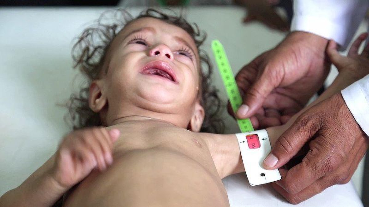 Niña yemení.