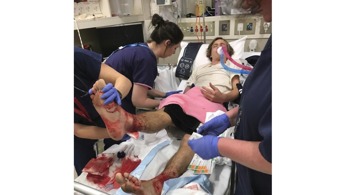 El adolescente Sam Kanizay recibe asistencia médica tras los mordiscos.