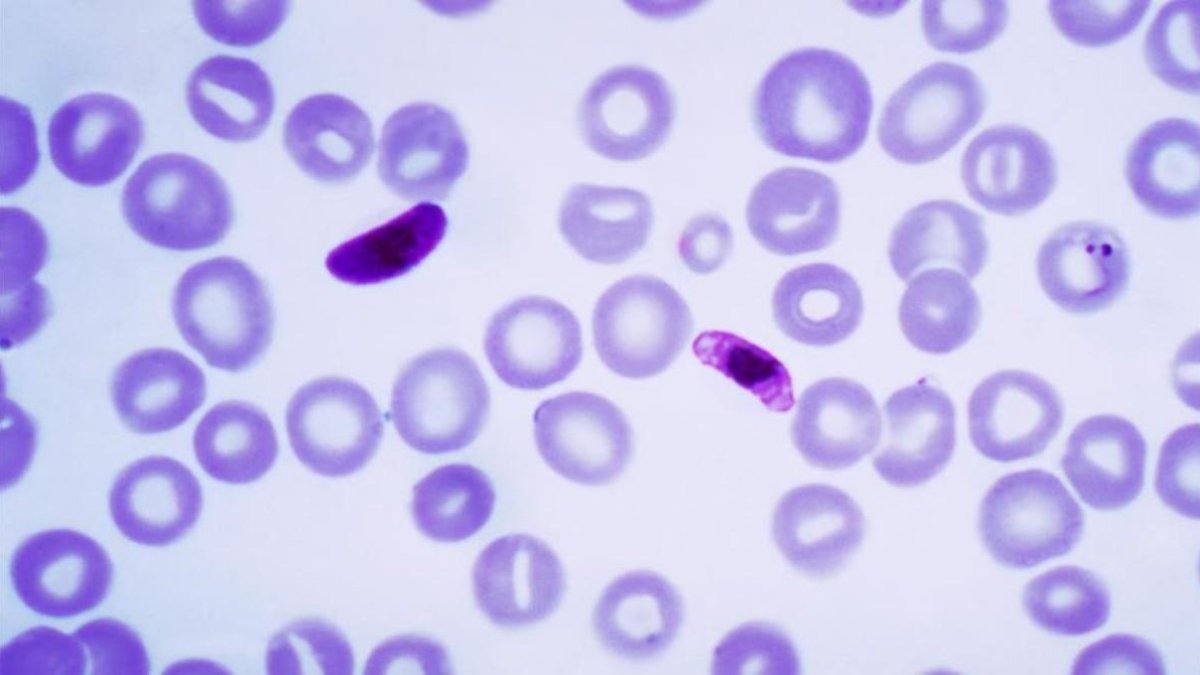 Imagen al microscopio de un protozoo parásito. /