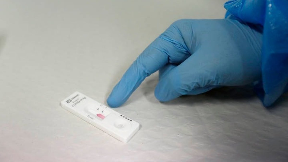 Un test de antígenos con positivo a covid. FERNANDO OTERO