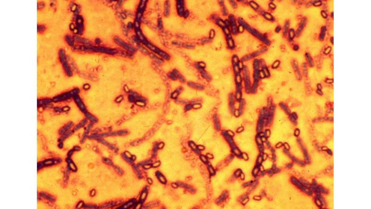 Esporas de la bacteria Bacilus antracis, que causa el ántrax, en una imagen de archivo.