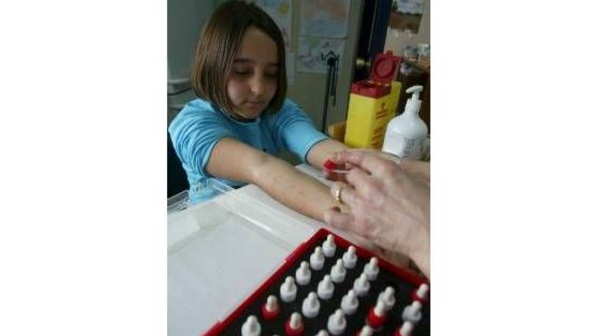 La psoriasis, como las alergias, puede aparecer a cualquier edad
