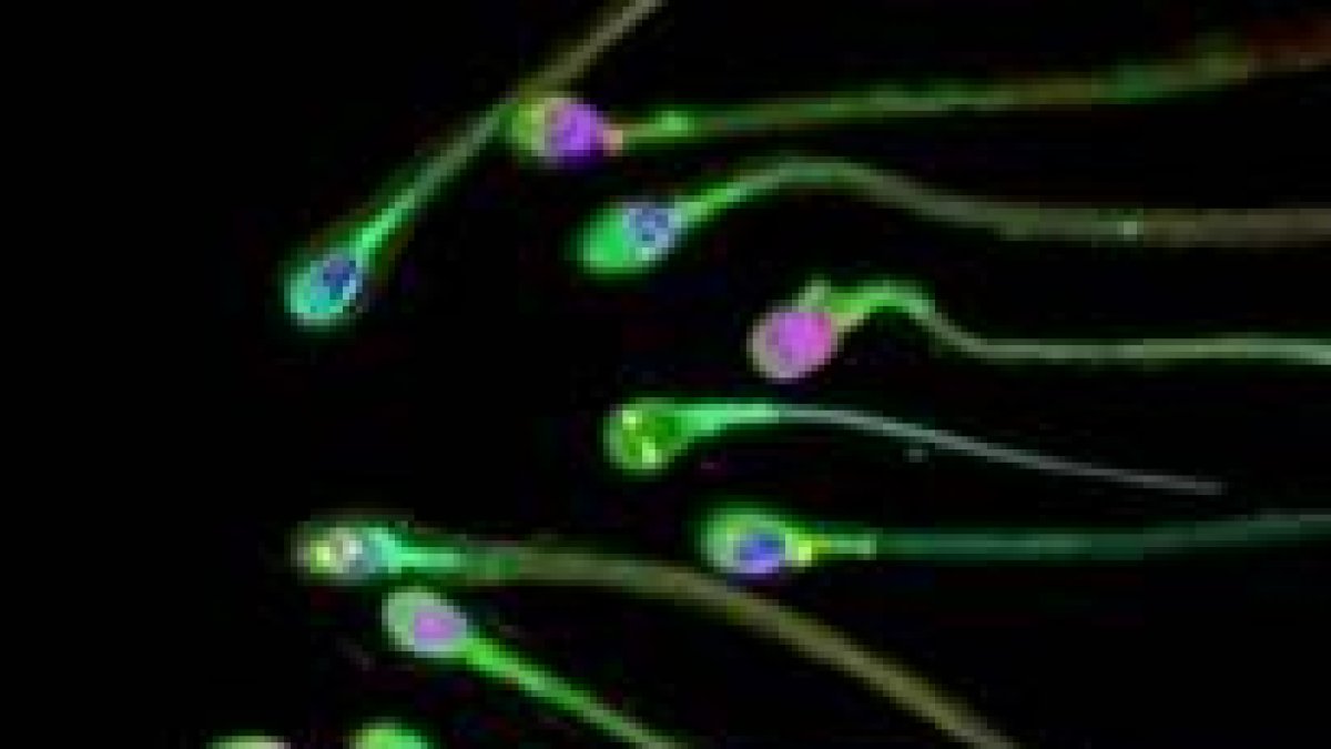 La esterilidad de una de cada cuatro parejas se debe a alteraciones en los espermatozoides