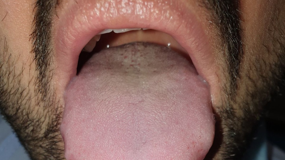 HOSPITAL UNIVERSITARIO LA PAZ