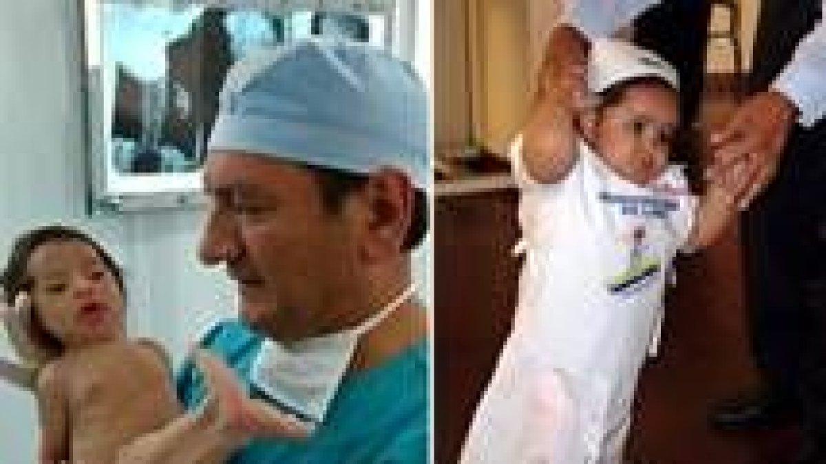 Combo fotográfico del antes y el ahora de la niña sirena