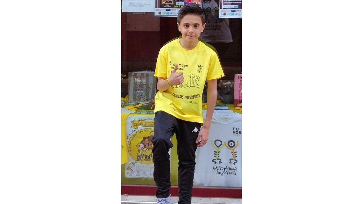 Slavi, viste el amarillo de la osteogénesis imperfecta. DL