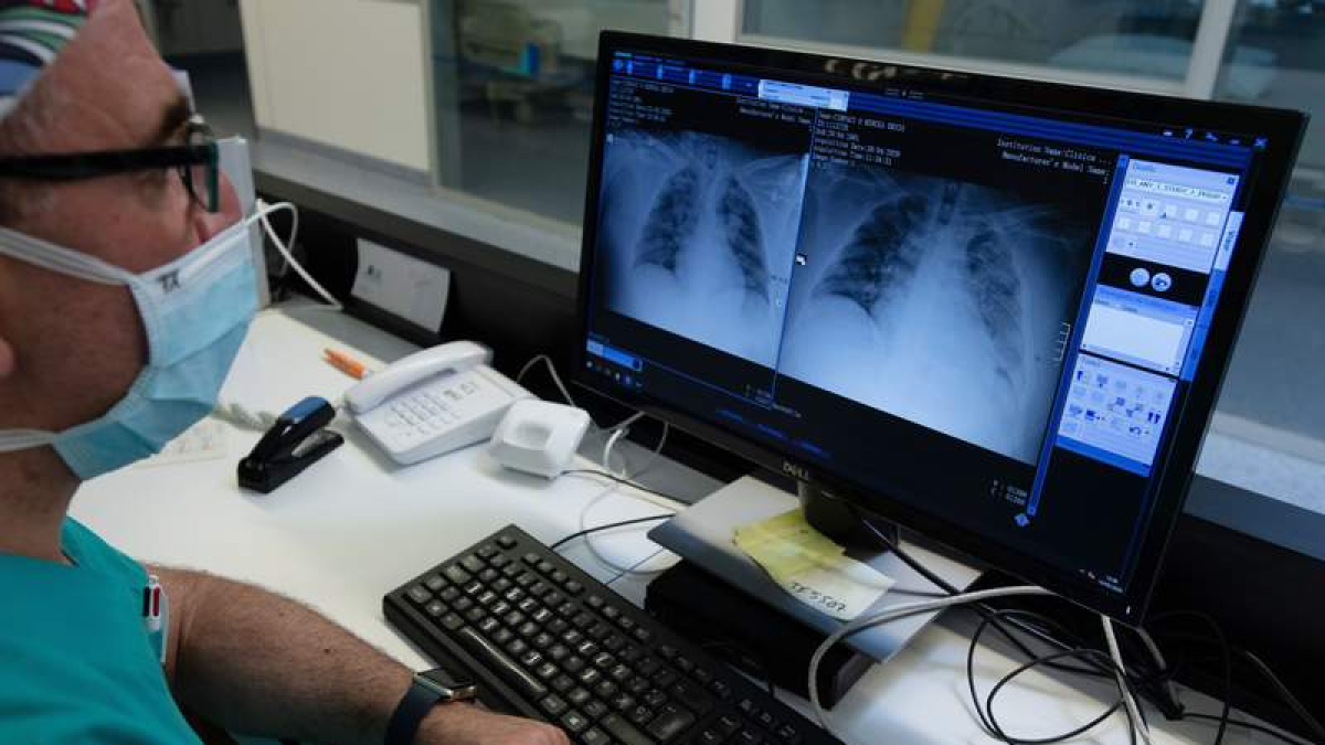 Un médico examina unas radiografías de pulmones. IÑAKI PORTO