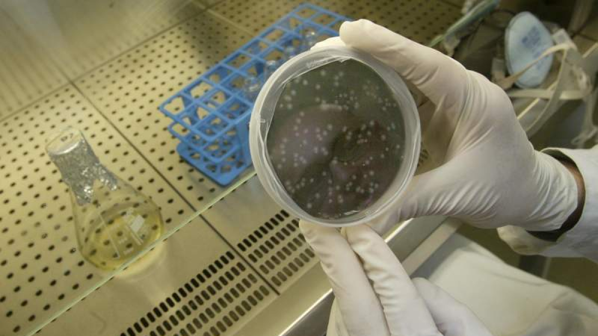 El Hospital de León tiene un equipo dedicado a la investigación de la tuberculosis.
