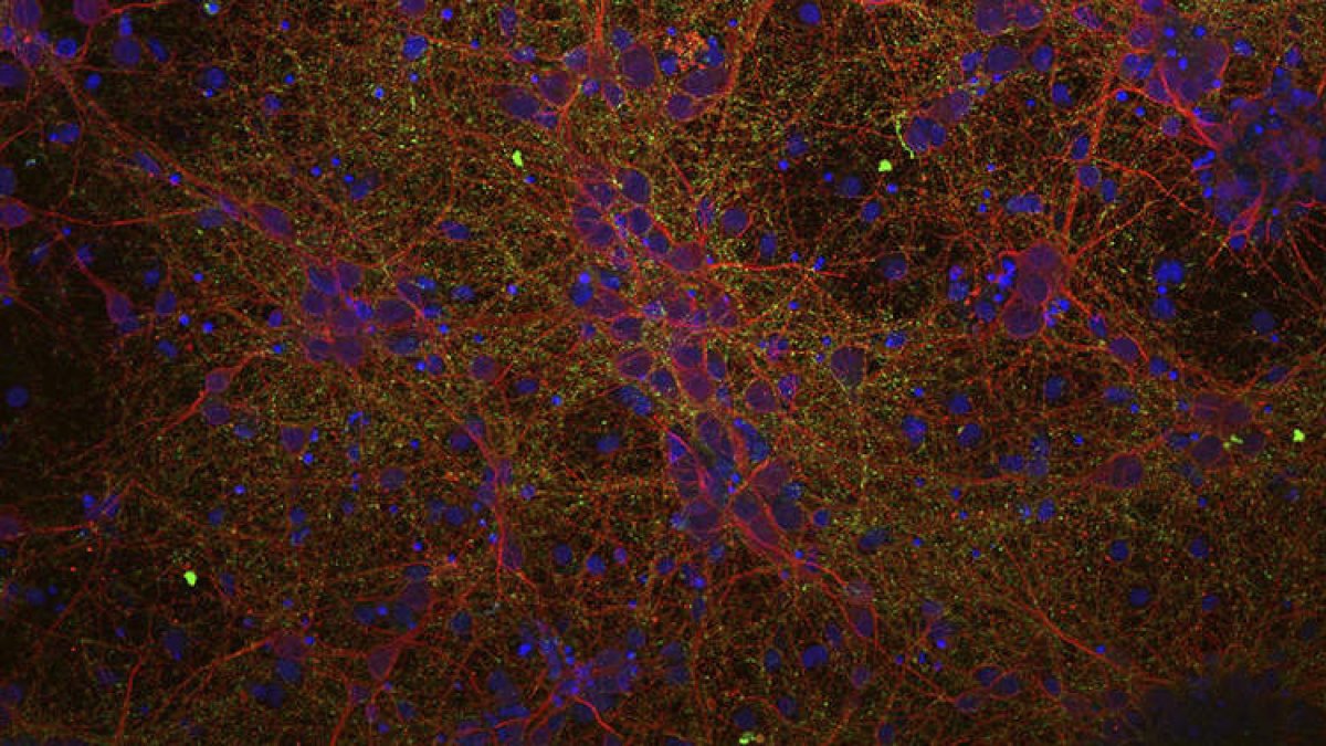 Imagen microscópica de células neuronales. INSTITUTO DE CIENCIAS MATERIALES DE MADRID