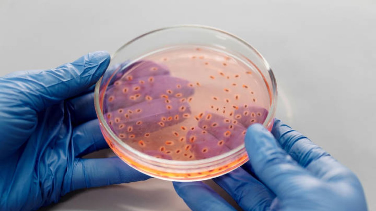 Cultivo microbiológico (ajeno a la investigación del EPFL).