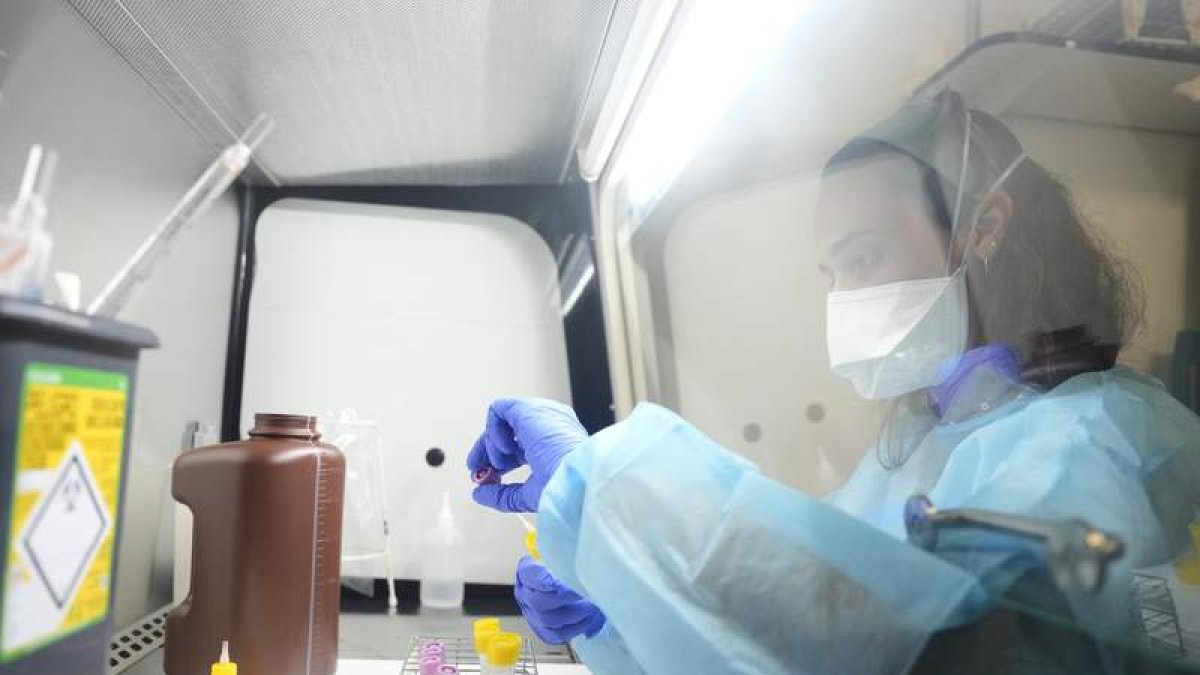 La viruela del mono es motivo de alerta sanitaria en estos momentos en Europa.