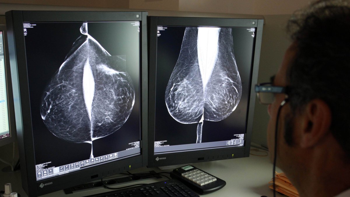 Estudio una mamografía digital, en el servicio de mamografías del Hospital Río Hortega de Valladolid