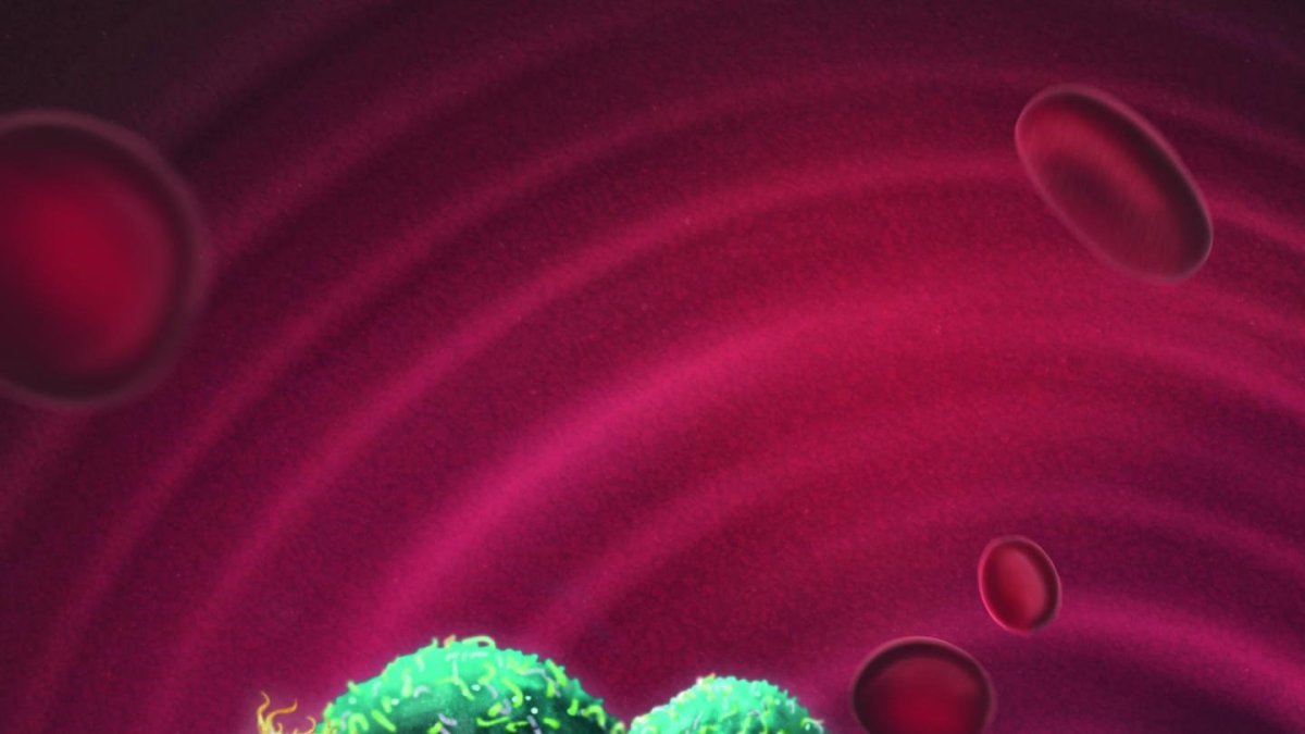 Archivo - Representación artística de células tumorales circulantes.