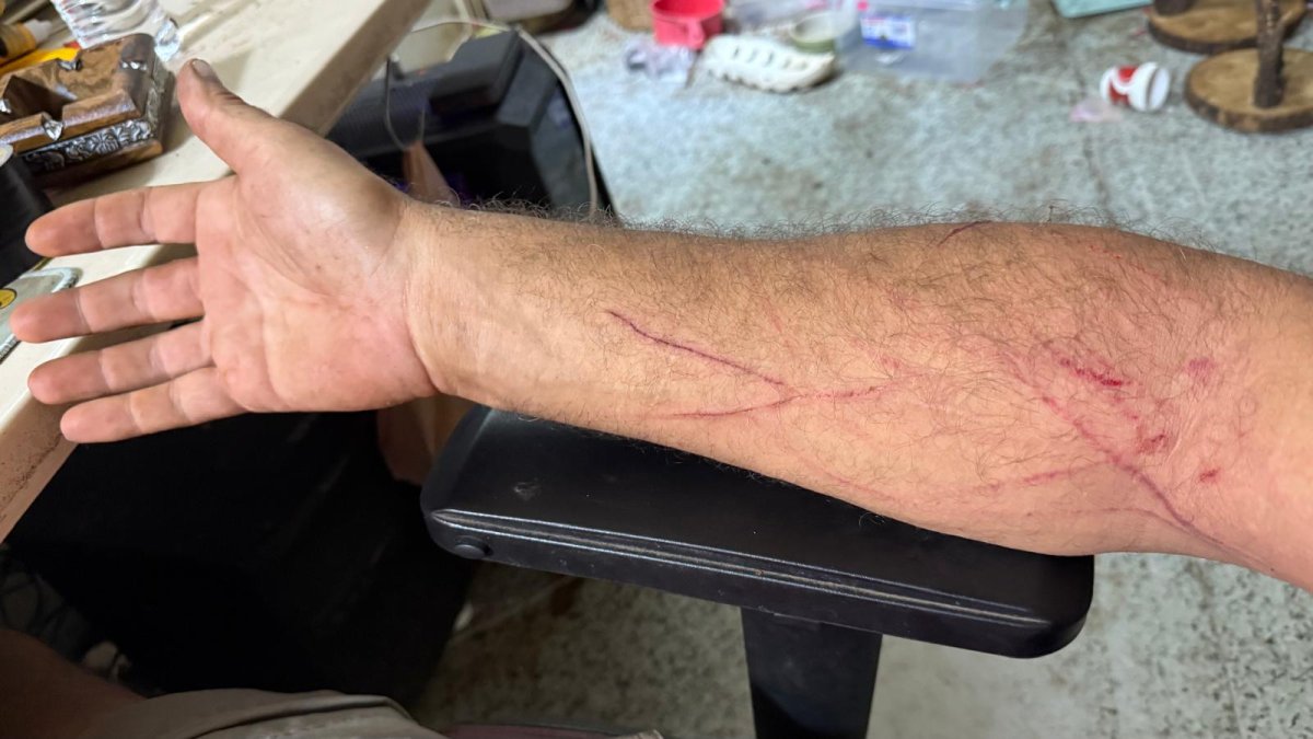 Brazo de Frank Cuesta tras el ataque.