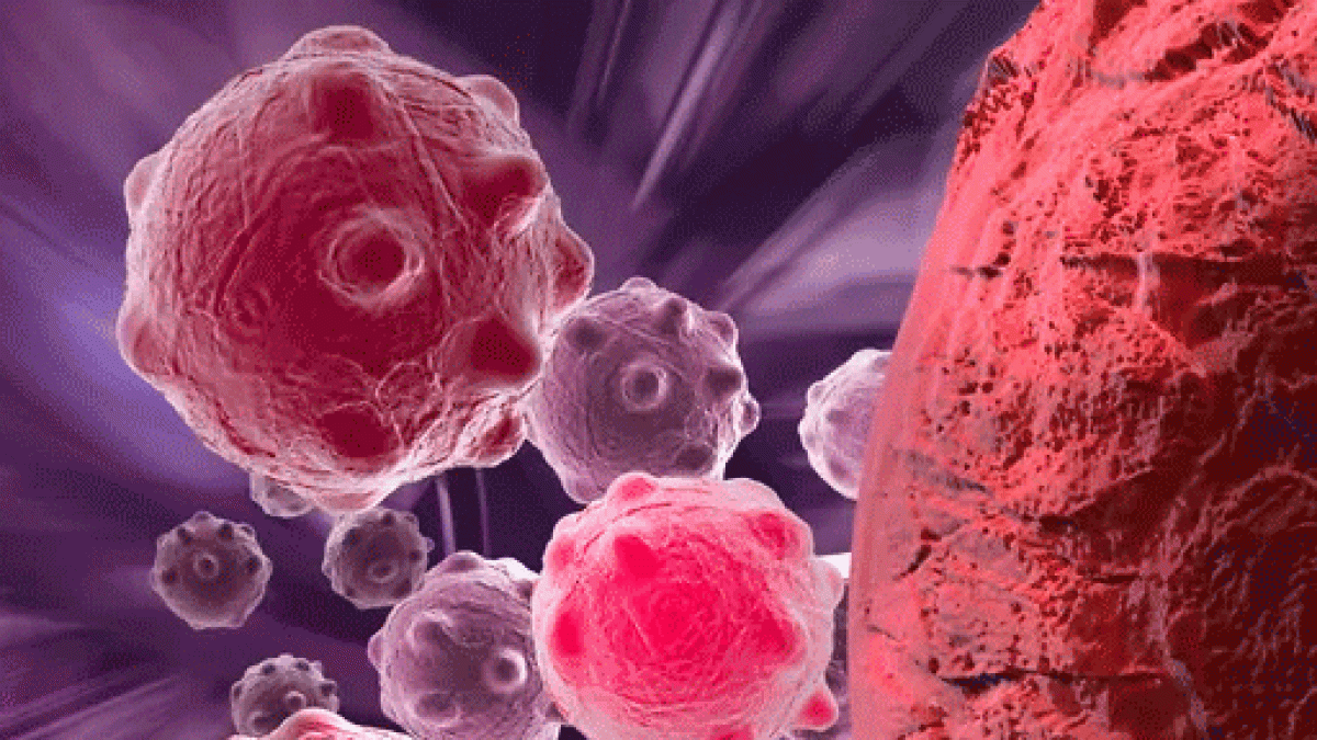 Así es la innovadora estrategia de inmunoterapia contra uno de los cáncer más agresivos creada por investigadores de la ule