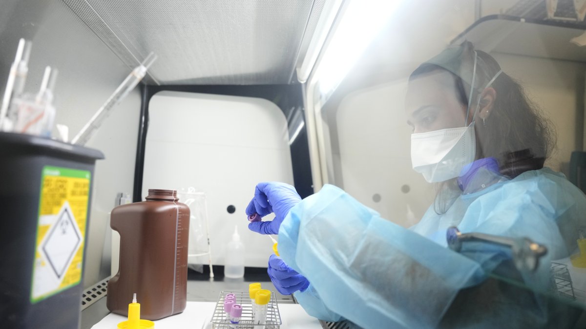 Pruebas del cribado de enfermedades de transmisión sexual.