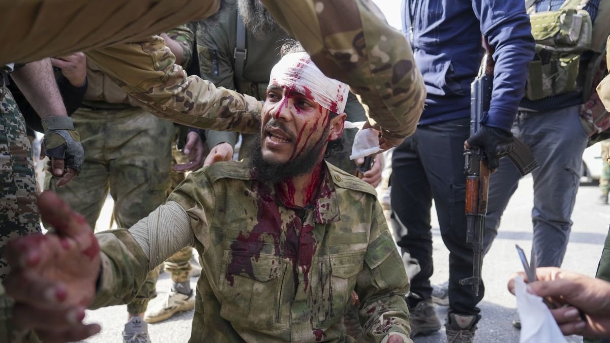 Un herido en los choques en Siria.