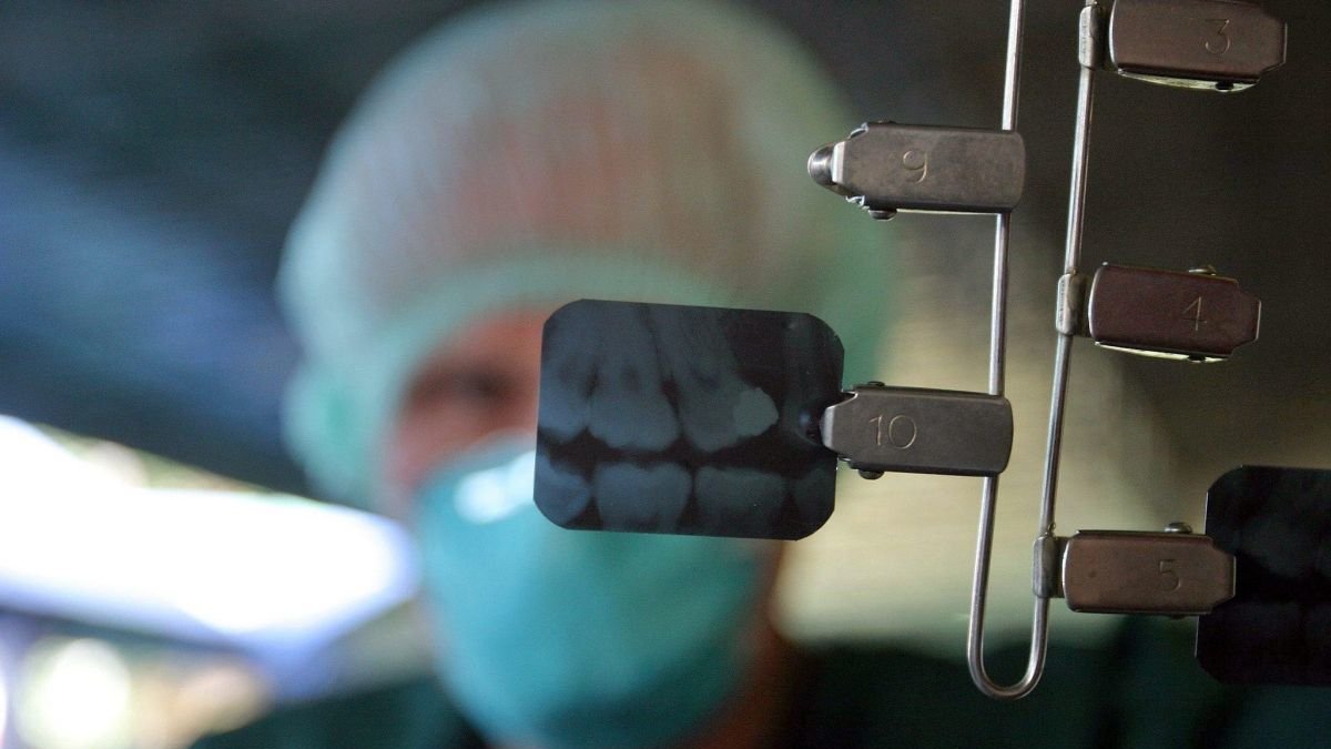 Radiografía de unos dientes.