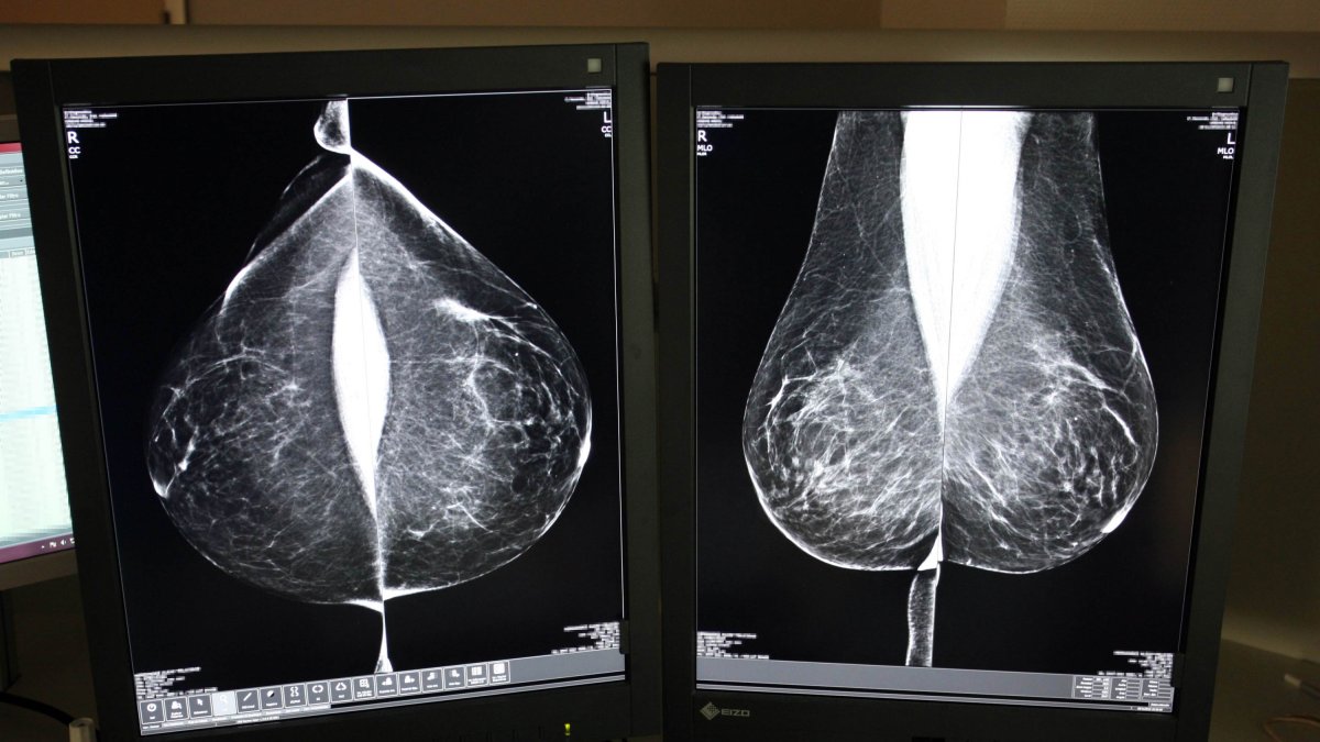 Estudio una mamografía digital, en el servicio de mamografías.