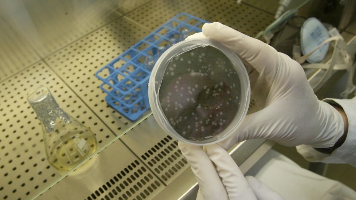 Una muestra con bacilos de la tuberculosis en un laboratorio de investigación.