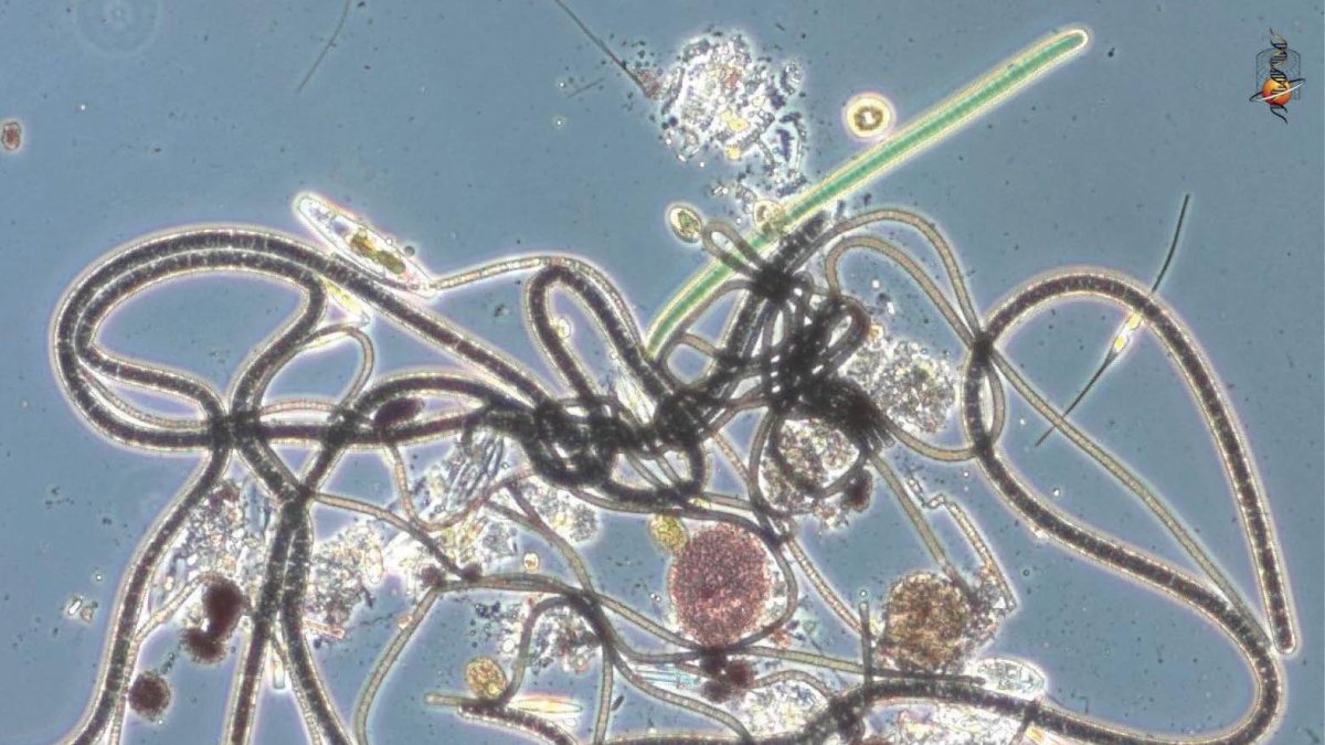El potencial curativo de los microorganismos es un avance con muchas incógnitas.