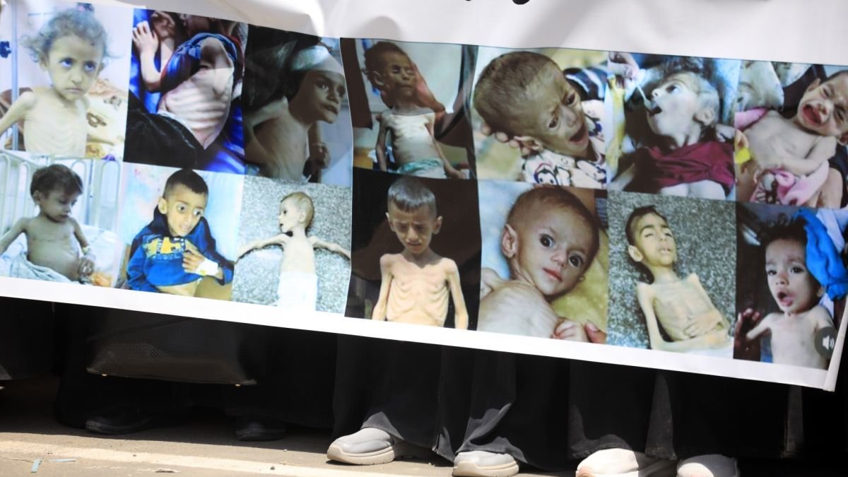 Fotos de niños palestinos muertos por hambre.