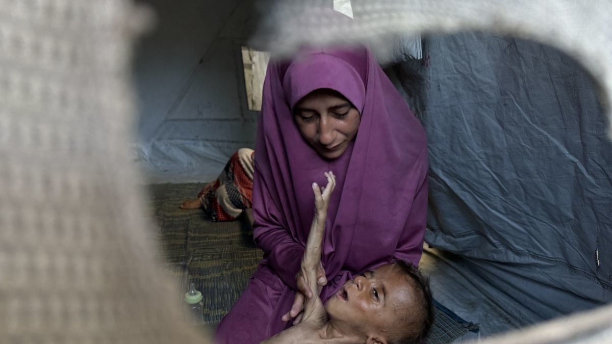 El pequeño gazatí Mohamed Motawaq, de cuerpo esquelético en brazos de su madre.