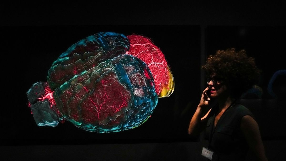 Una mujer pasa por una lustración del cerebro.