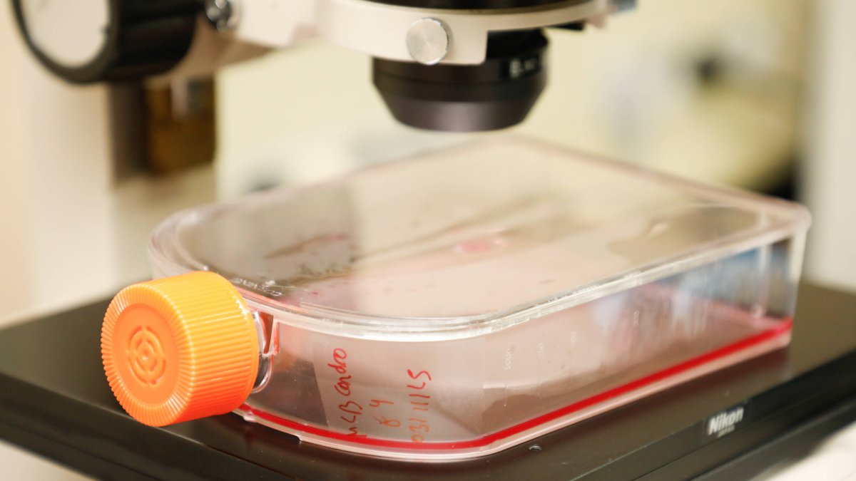 Biolfar utiliza los medios más adecuados para investigar el secretoma.