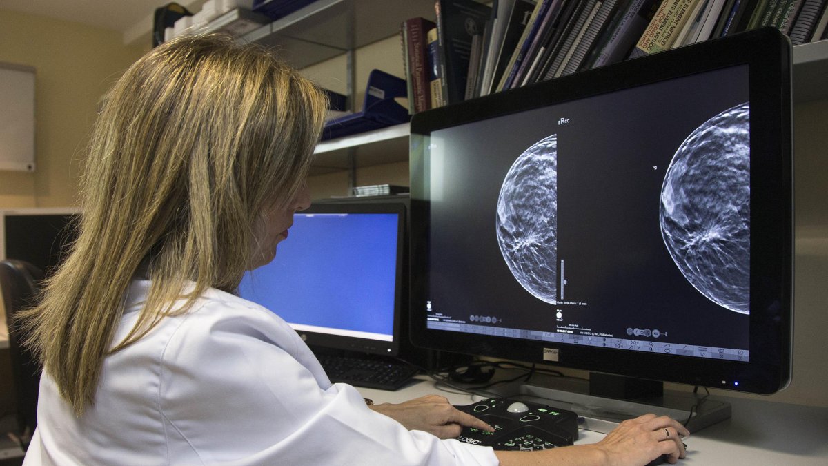 Una doctora observa una mamografía en una imagen de archivo.EFE/ Miguel Angel Polo.