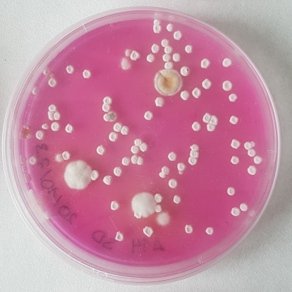 Cultivo directo desde castaña.